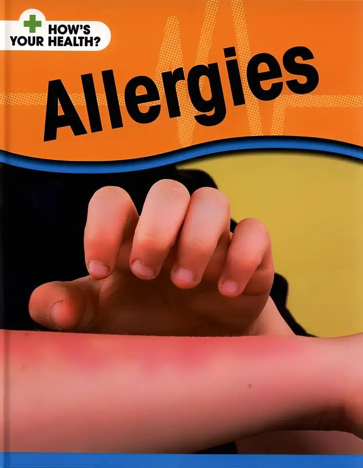 It's Not Catching: Allergies Hardback