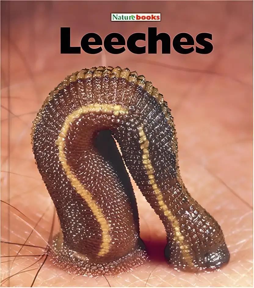 Leeches